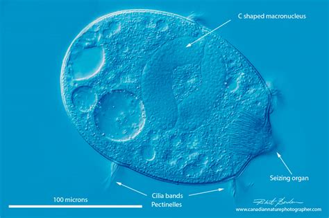 Didinium -  A Tiny Ciliate Predator With an Ingenious Hunting Technique!