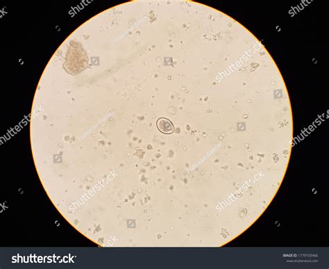  Isospora! A Deep Dive into the Microscopic World of These Tiny Intestinal Parasites