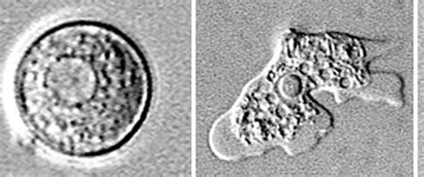  Naegleria - A Brain-Eating Amoeba That Lurks in Warm Waters!