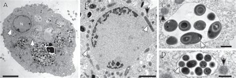  Pelomyxa! A Single-Celled Wonder That Eats Entire Bacteria for Breakfast